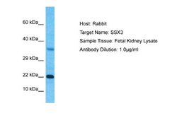 SSX3 Antibody, Novus Biologicals 100 &mu;L | Buy Online | Novus Biologicals | Fisher Scientific